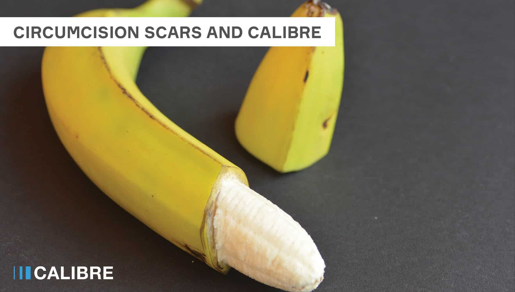 Circumcision Scars and CALIBRE Clinic