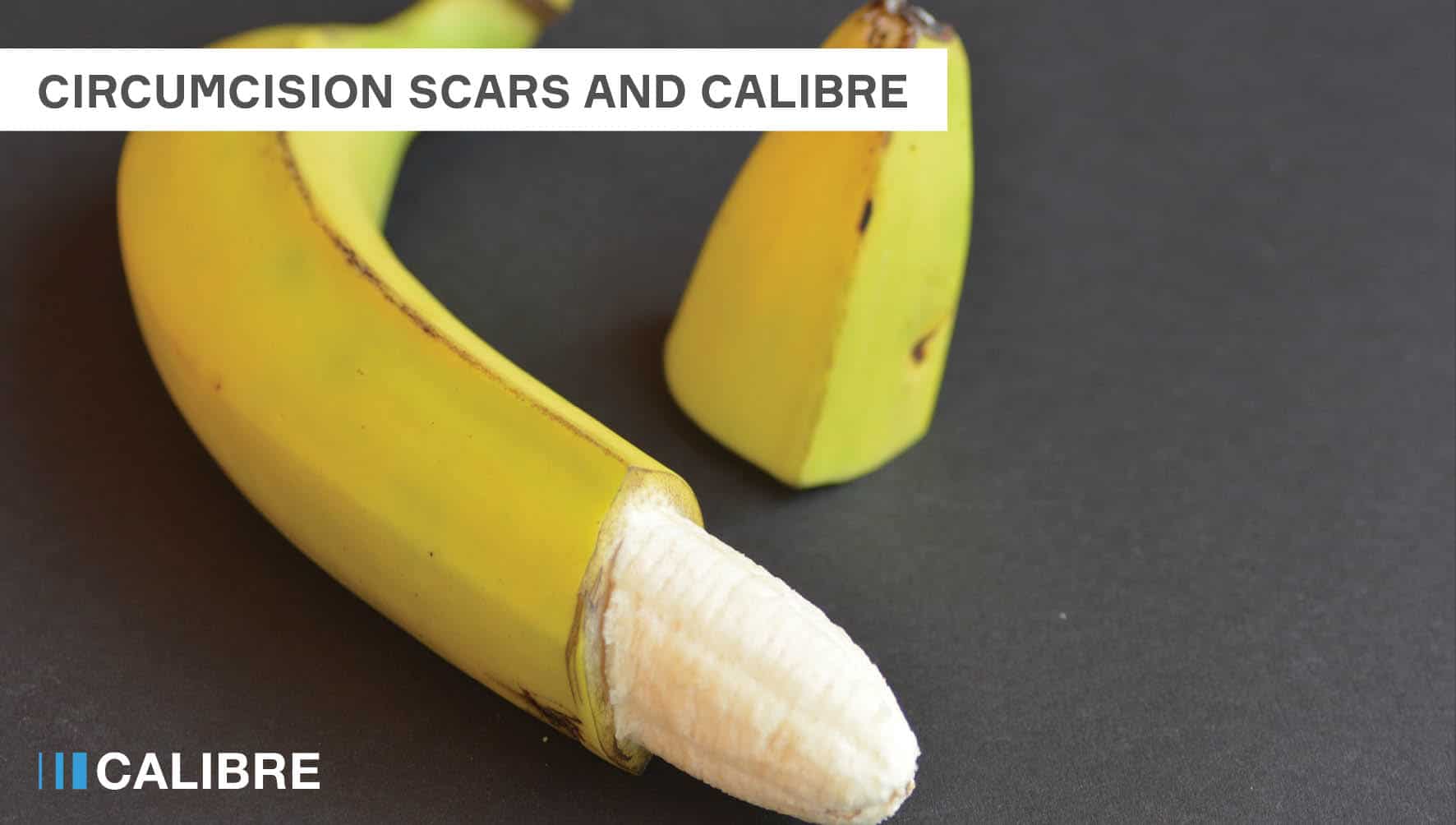 Circumcision Scars Does It Complicate Your Penis Augmentation 